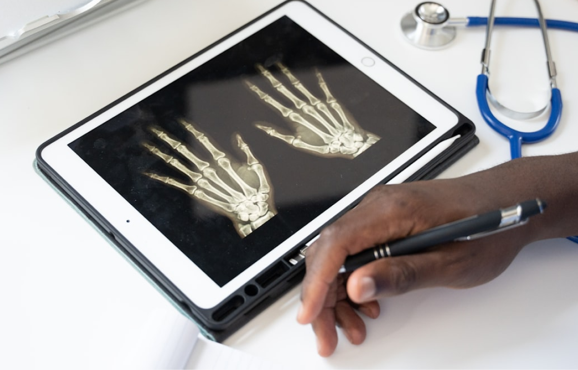 ANGON forms editor interface with drag and drop elements